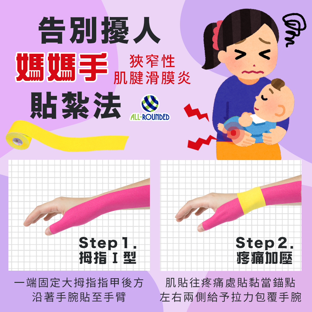 媽媽手 腕隧道症