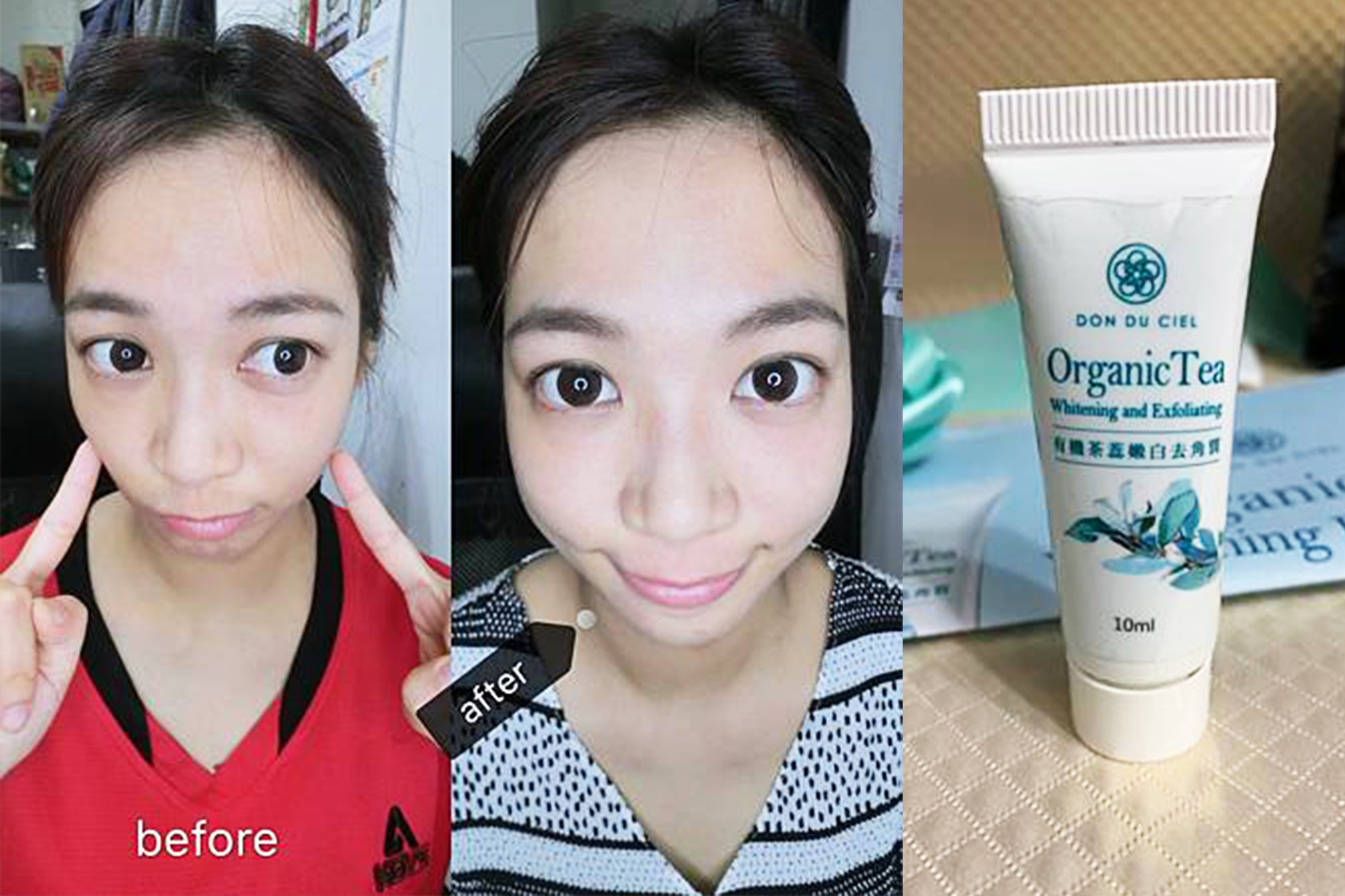 美白保養夏日美白