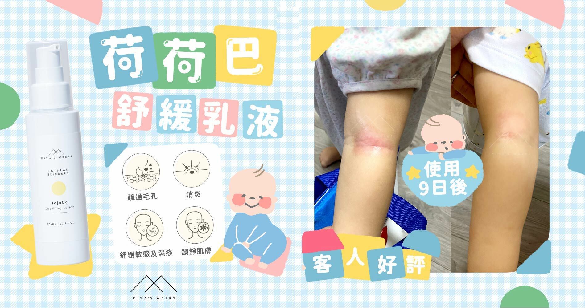 使用9天荷荷巴舒緩乳液效果顯著