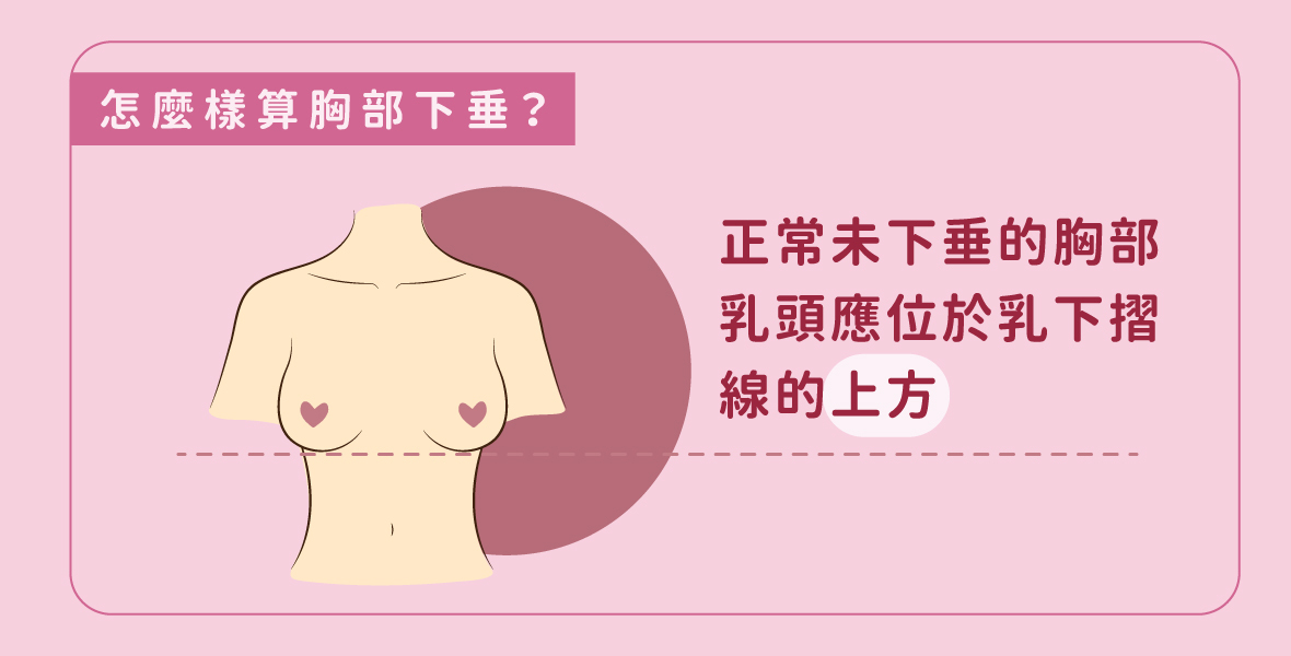 胸部嚴重下垂怎麼辦?胸部下垂定義
