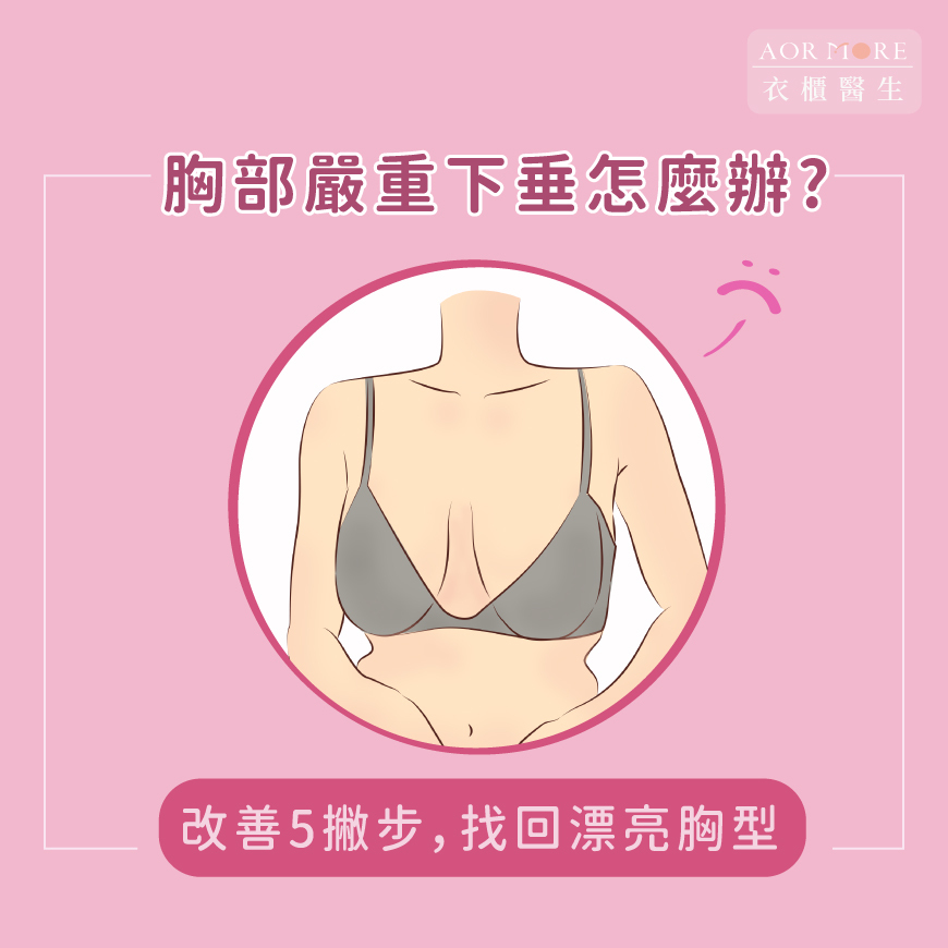 胸部嚴重下垂怎麼辦?