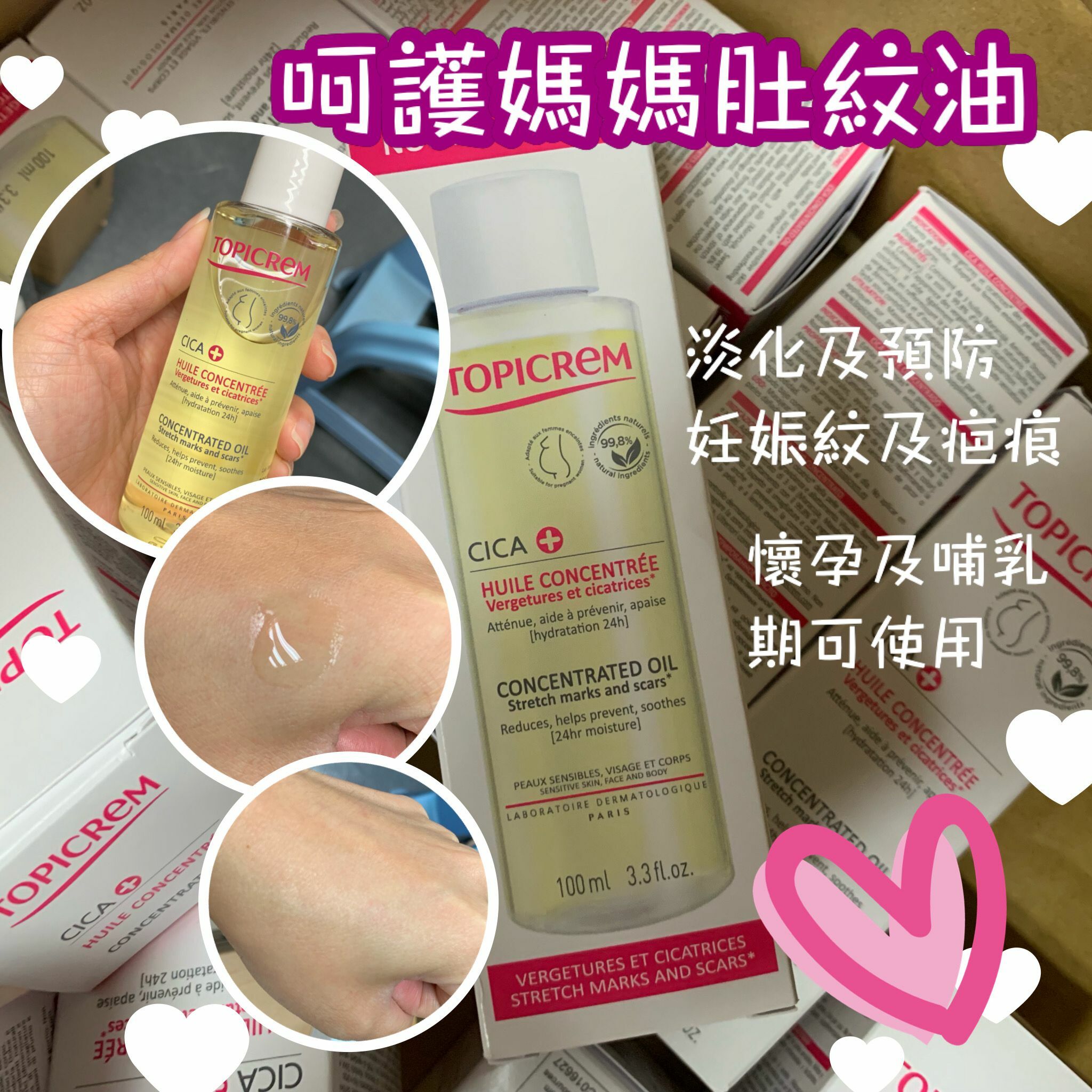 TOPICREAM CICA concentrate oil 去紋去疤護膚油100ml