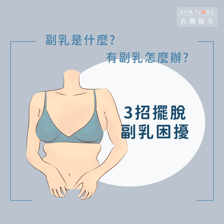 有副乳怎麼辦?3招擺脫副乳困擾
