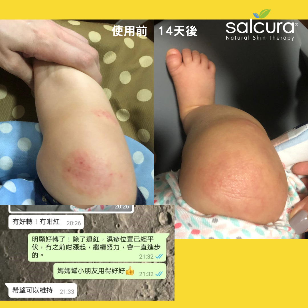 Salcura 植萃舒緩抗敏噴霧 100ml (嬰幼兒)