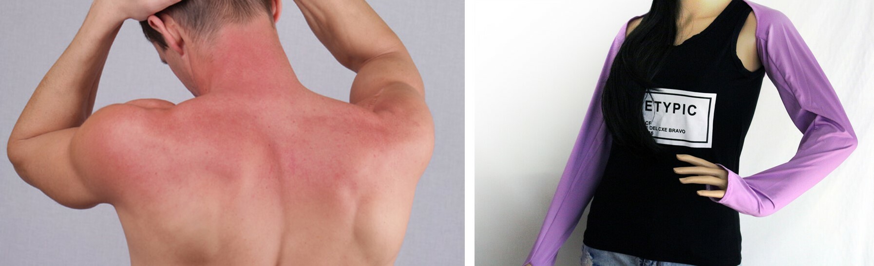 夏天穿太少反而容易曬傷。