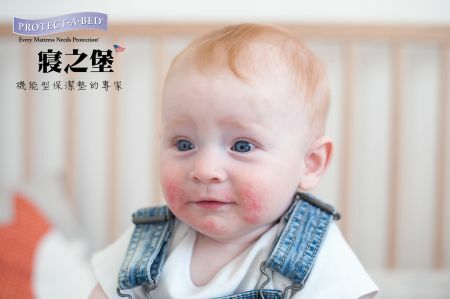 換季、過敏，認識異位性皮膚炎, 寢之堡, 保潔墊