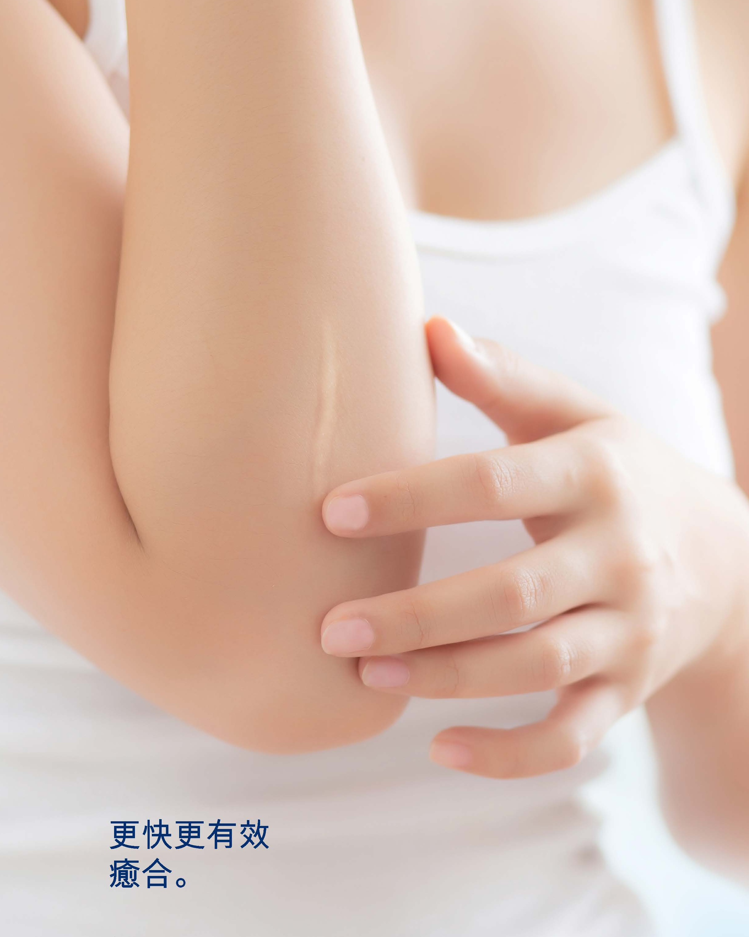 KELO CELL Fast to recover