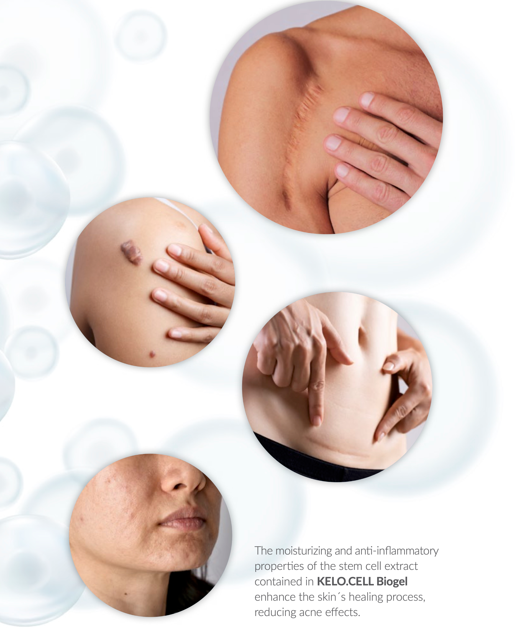 KELO CELL BIOGEL UNIQUE DUAL ACTION FORMULA, ACTS IN 2 PHASES OF THE HEALING PROCESS