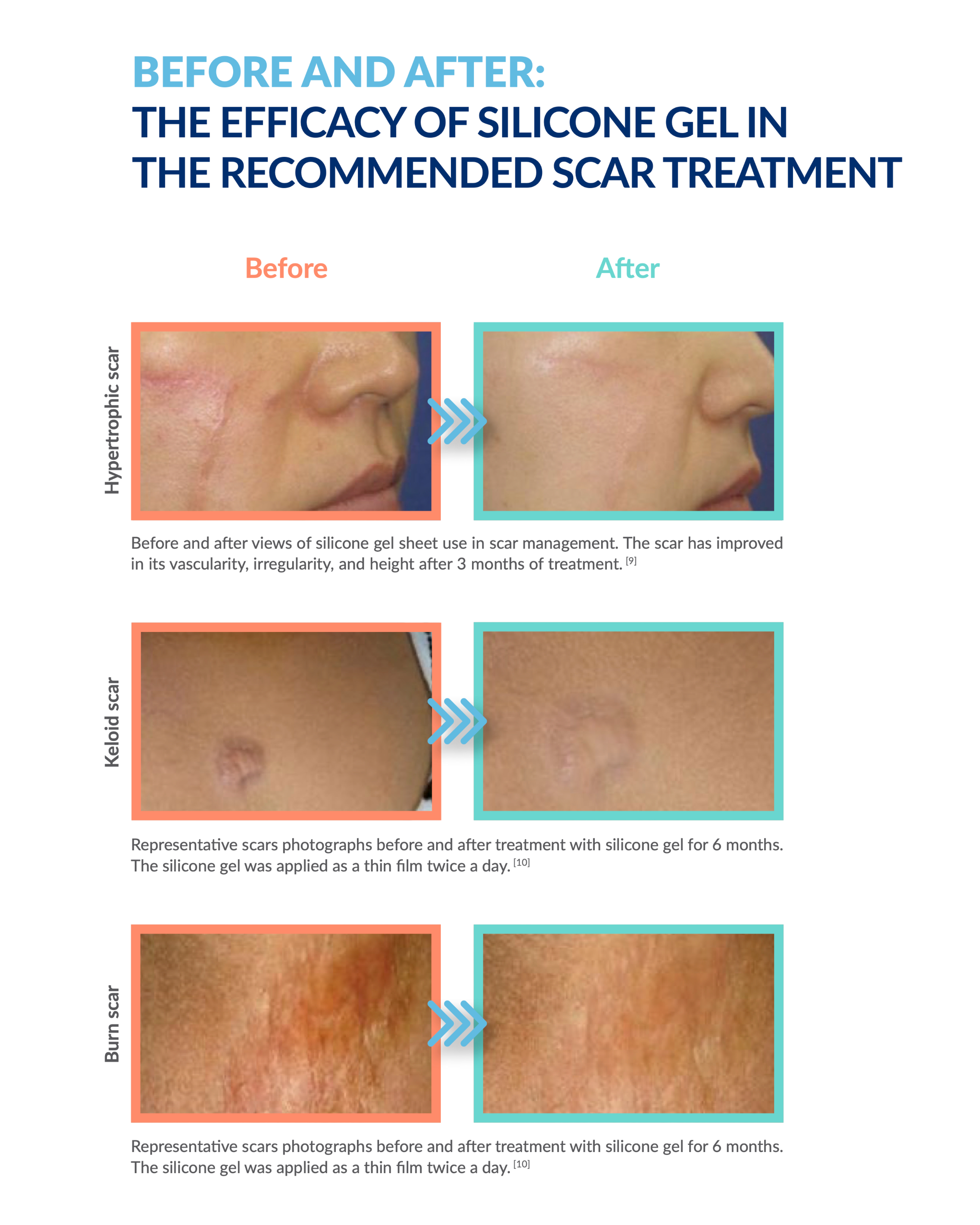 KELO CELL Biogel THE EFFICACY OF SILICONE GEL IN THE RECOMMENDED SCAR TREATMENT