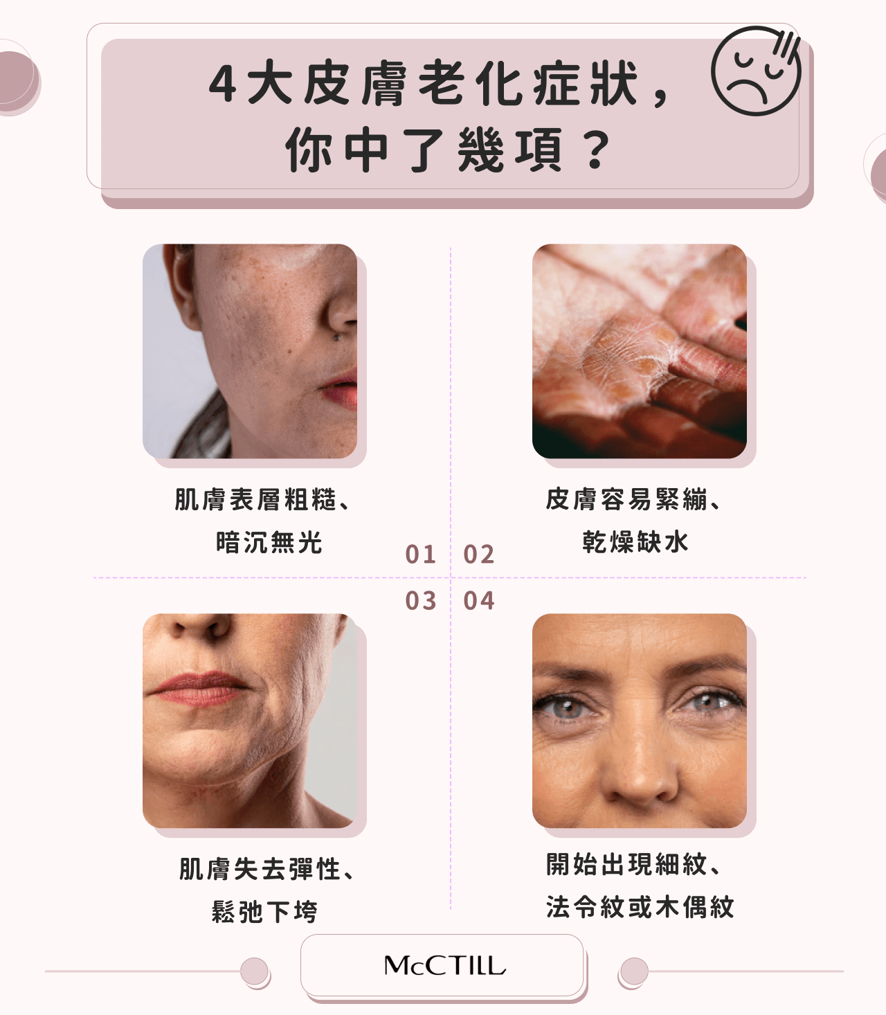 4大皮膚老化症狀,你中了幾項? 1.粗糙暗沉 2.緊繃、乾燥 3.鬆弛下垮 4.出現細紋