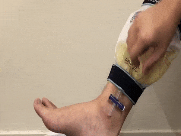 ActivGo男性尿用護理組配件,專利尿袋使用示範影片,省力排尿不沾手 ActivGo男性尿用護理組配件,尿袋實際流尿防示範影片