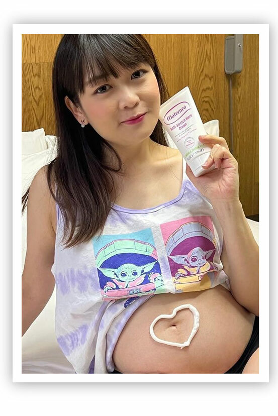 Maternea 防妊娠紋