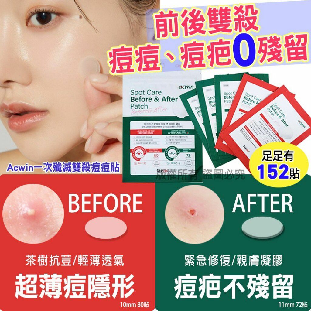 韓國Acwin一次殲滅雙殺痘痘貼152貼