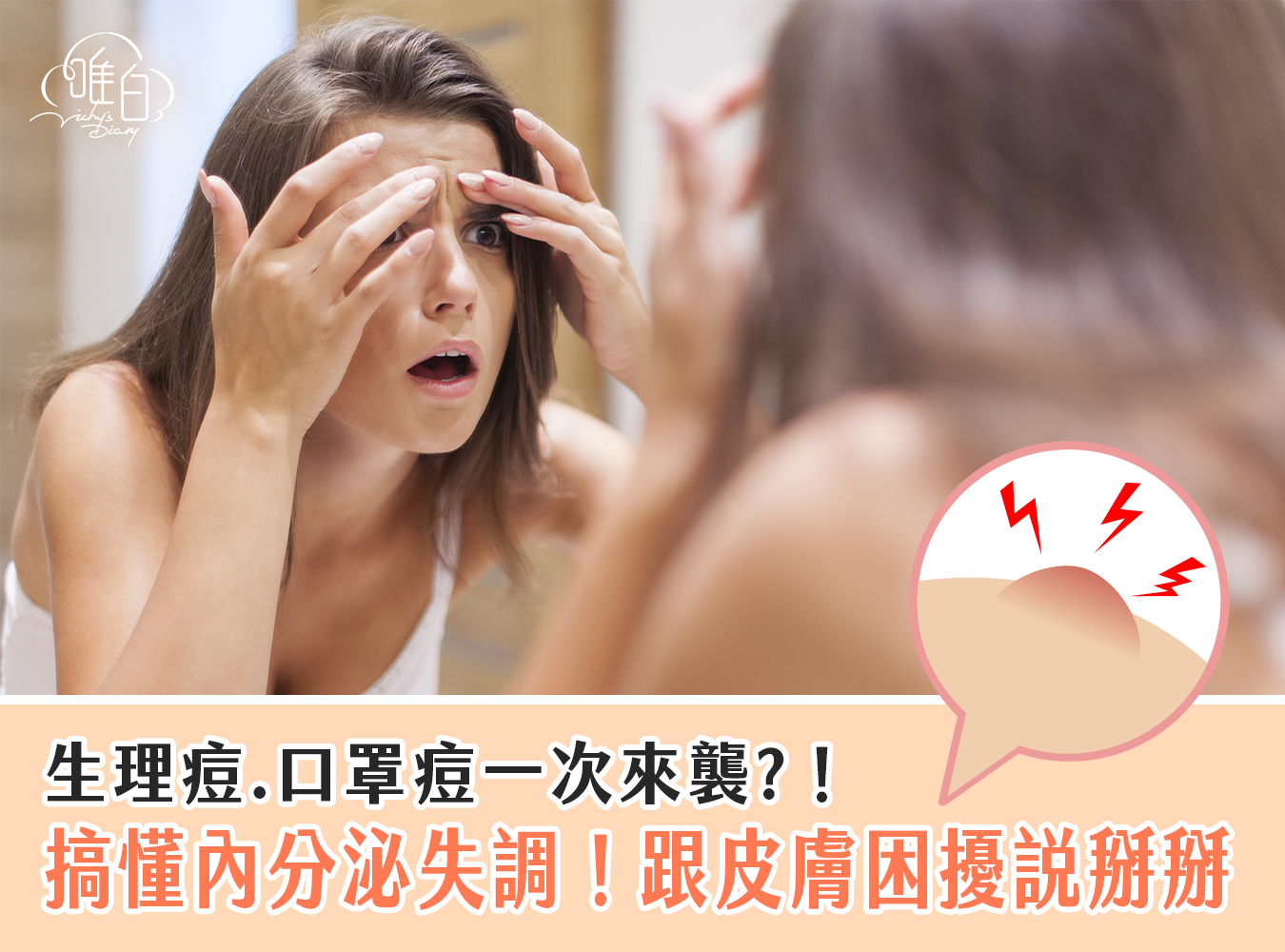 內分泌失調,月經,經痛,生理期,生理痘,口罩痘,口罩,疫情,皮膚保養,夏天,濾泡期,黃體期,高升糖指數,飲食,飲食控管,日常作息,壓力,熬夜,亂經,經痛