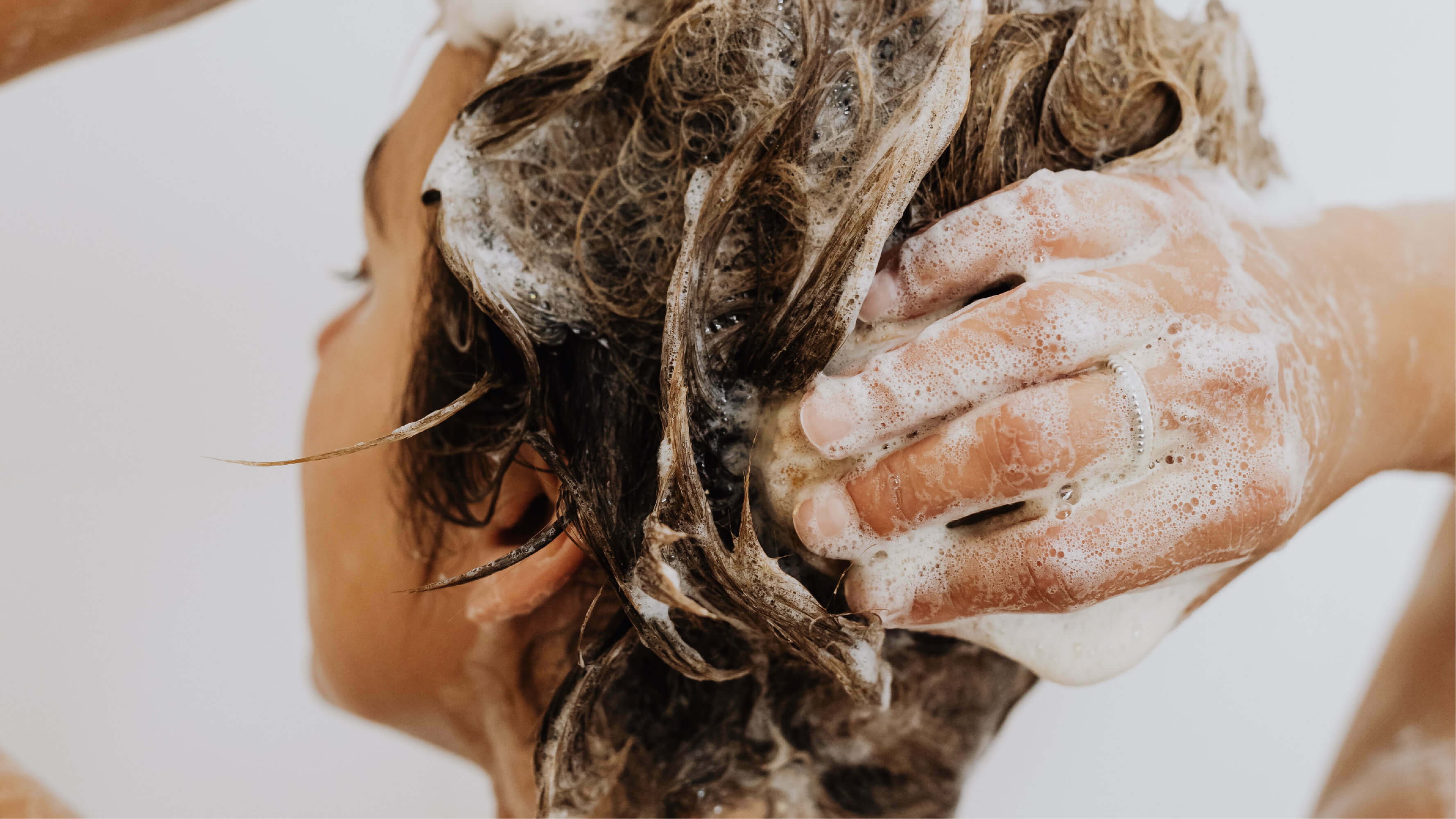 為什麼每天洗頭還是頭皮癢？