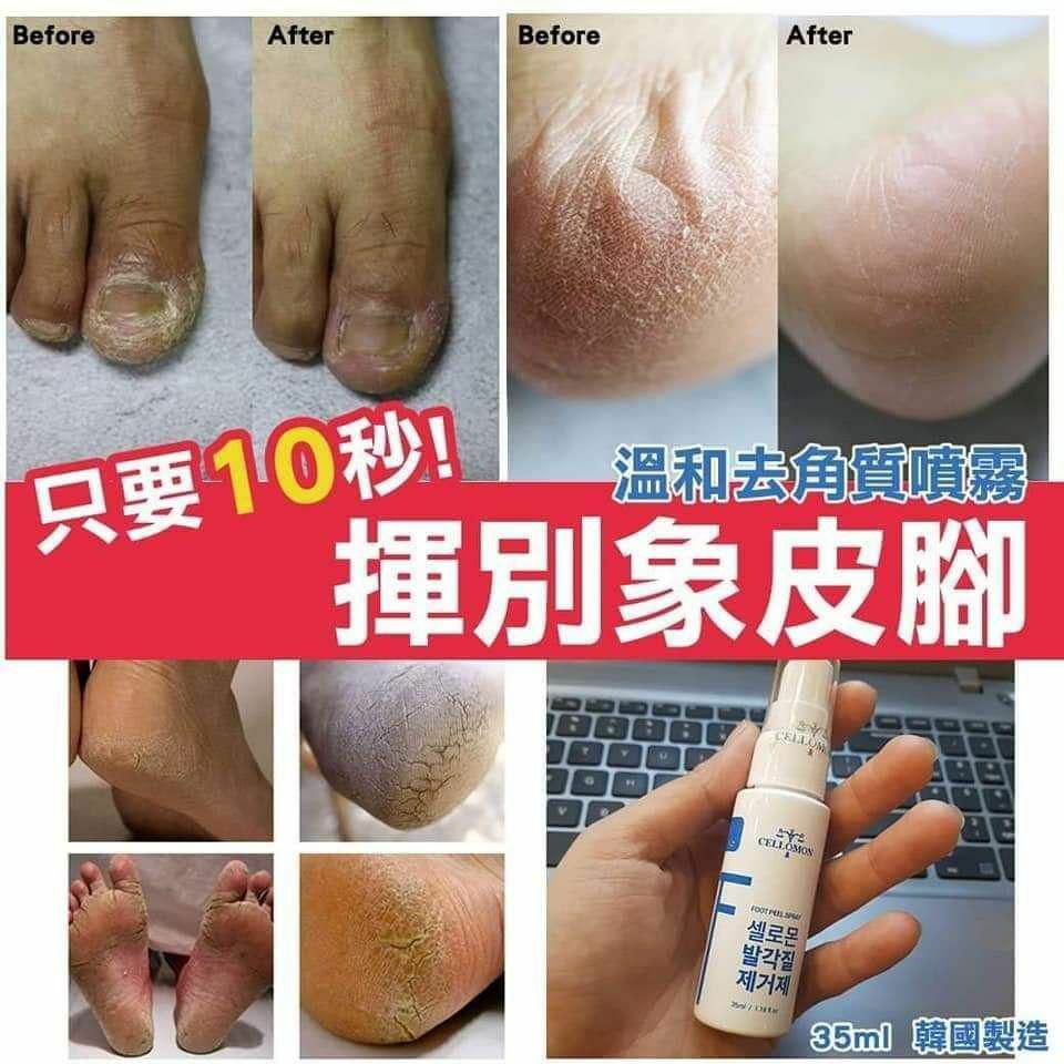 韓國CELLOMON 10秒足部去角質噴霧 35ML