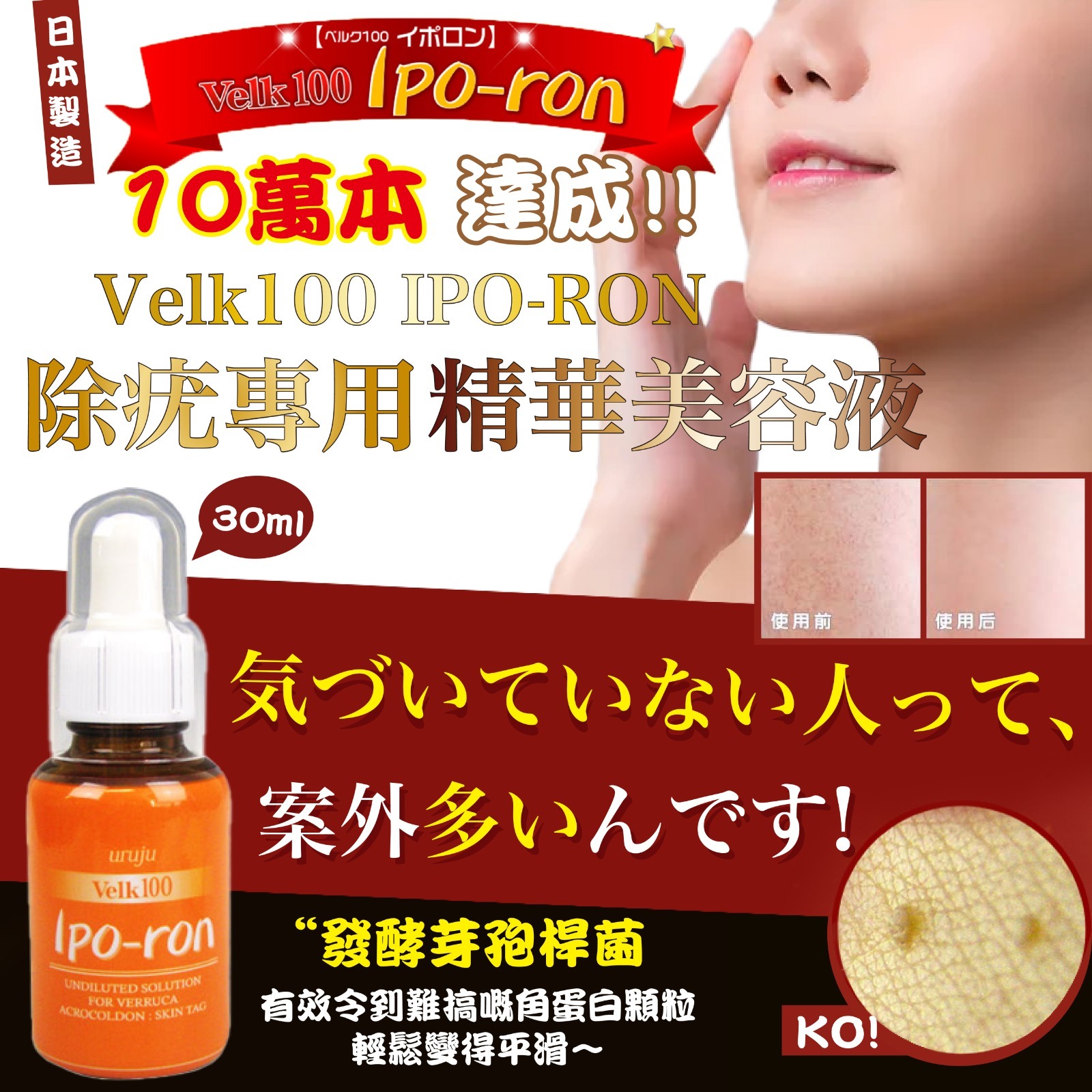 日本製Velk100 IPO-RON除疣專用精華美容液 30ml