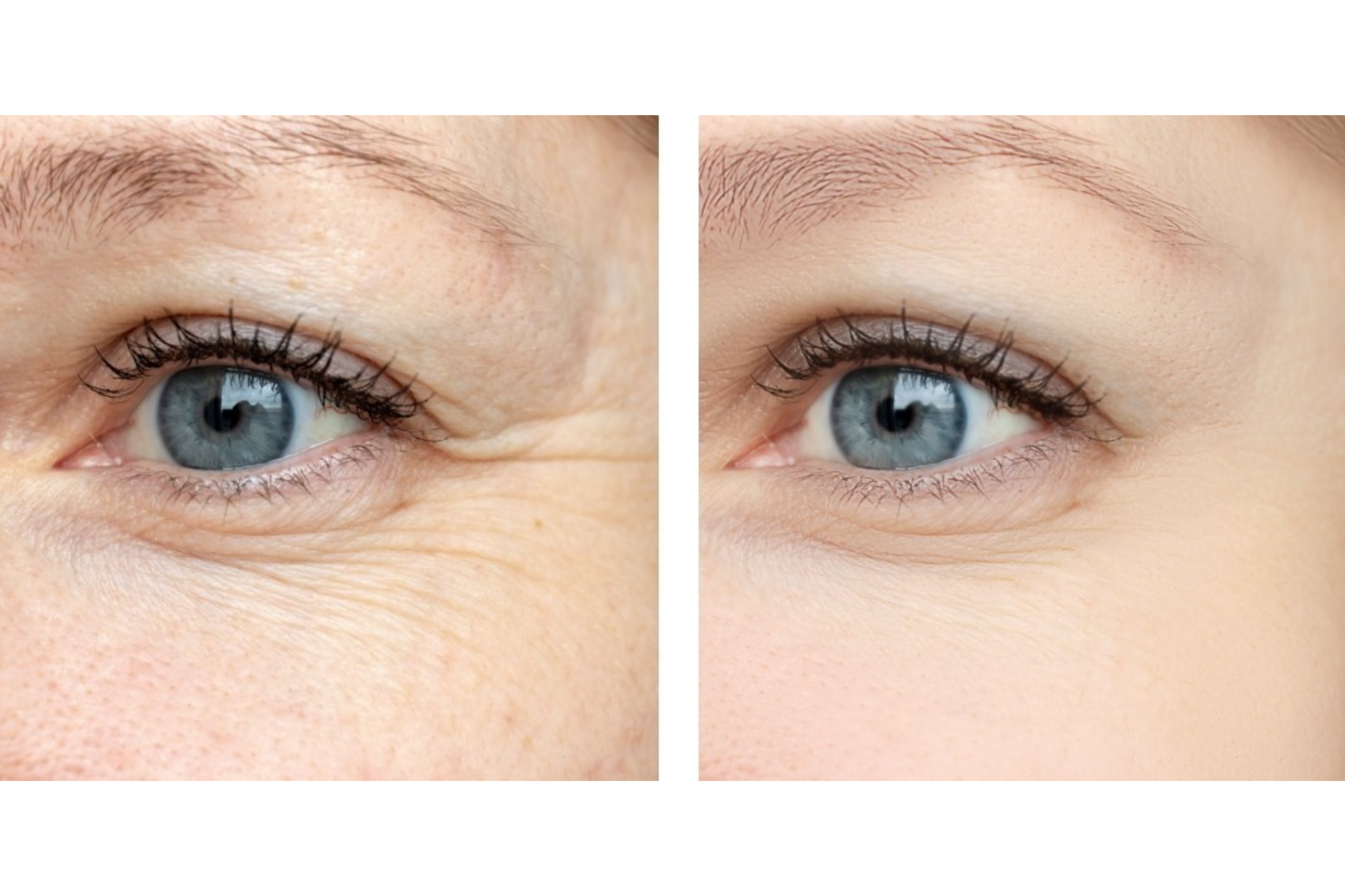 熟齡保養品該如何挑選？掌握3大秘訣，熟齡肌保養方法大公開