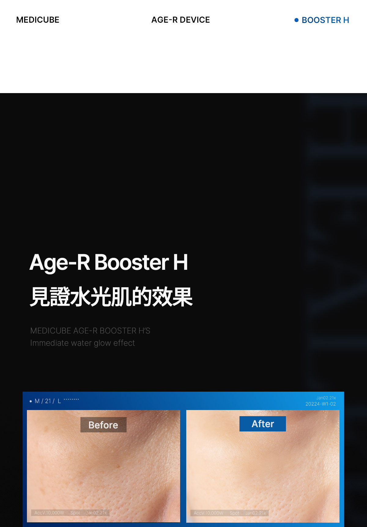 水光導入] Age-R Booster H