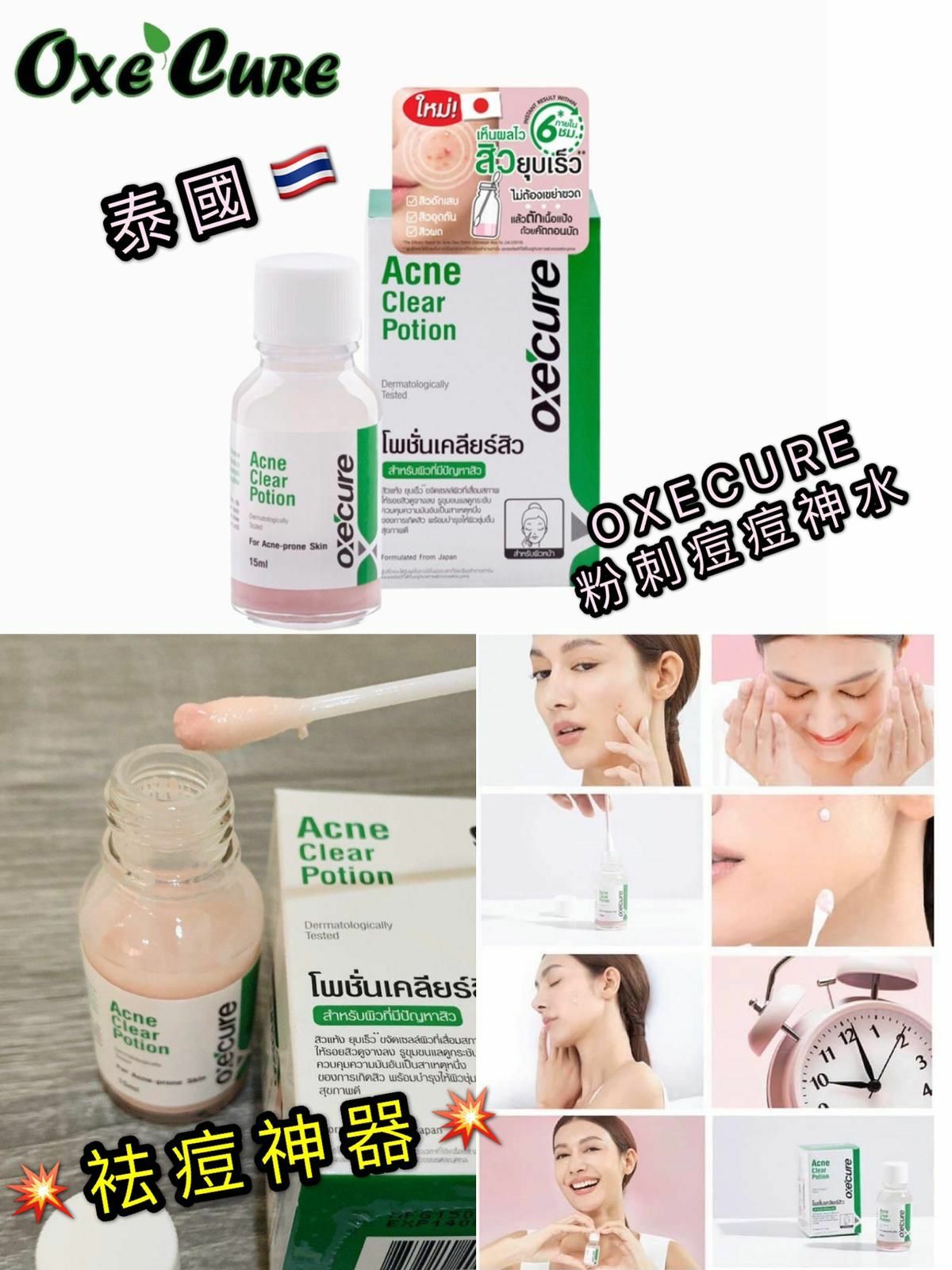 泰國OXECURE Acne Clear Potion 粉刺痘痘神水15ml