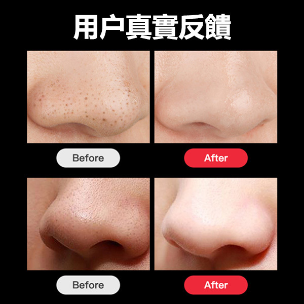 韓國JK VLVEE家用電動吸黑頭毛孔清潔器美容儀器 (J0380)