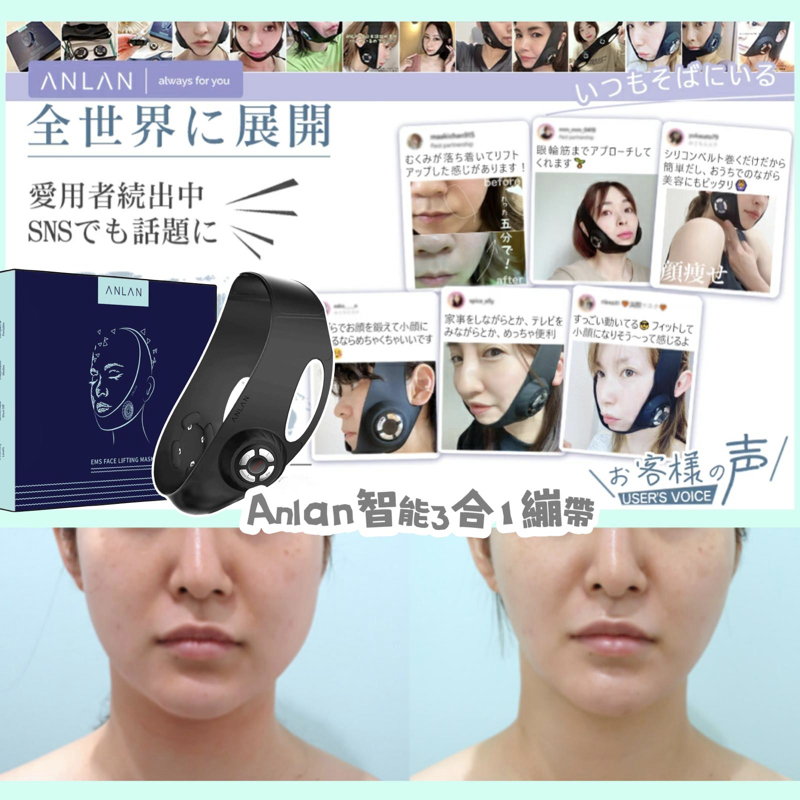 Anlan 智能光學V -line 繃帶