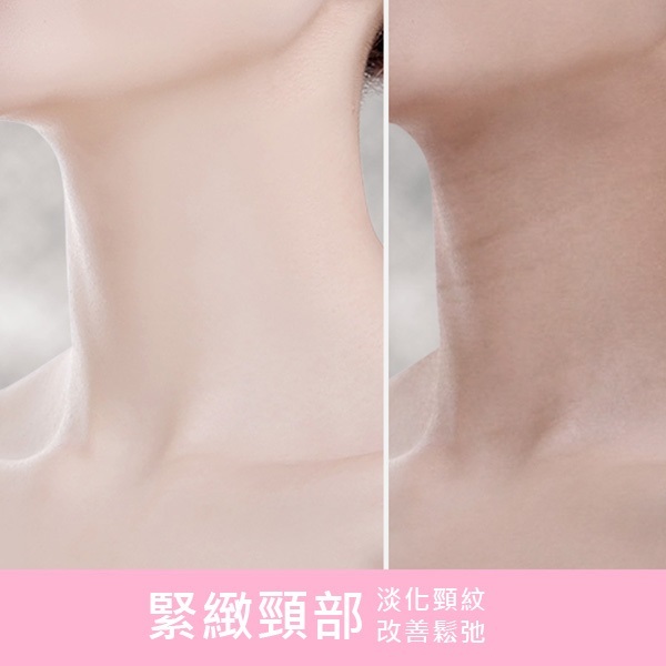 JK Korea new EMS neck massager IPL rejuvenation neck beauty instrument to remove neck lines, decrees, eye lines, facial beauty instrument (J0612)