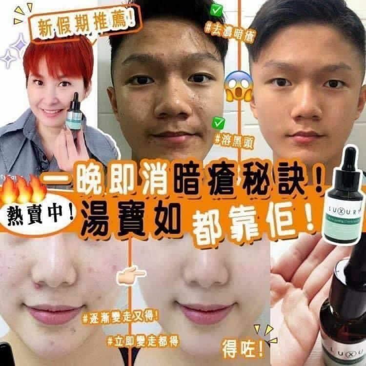 👸🏻女皇粉剌水👸🏻去黑頭粉刺水💓保濕、舒緩敏感、去印好得🉐🉐🉐🉐🉐🉐