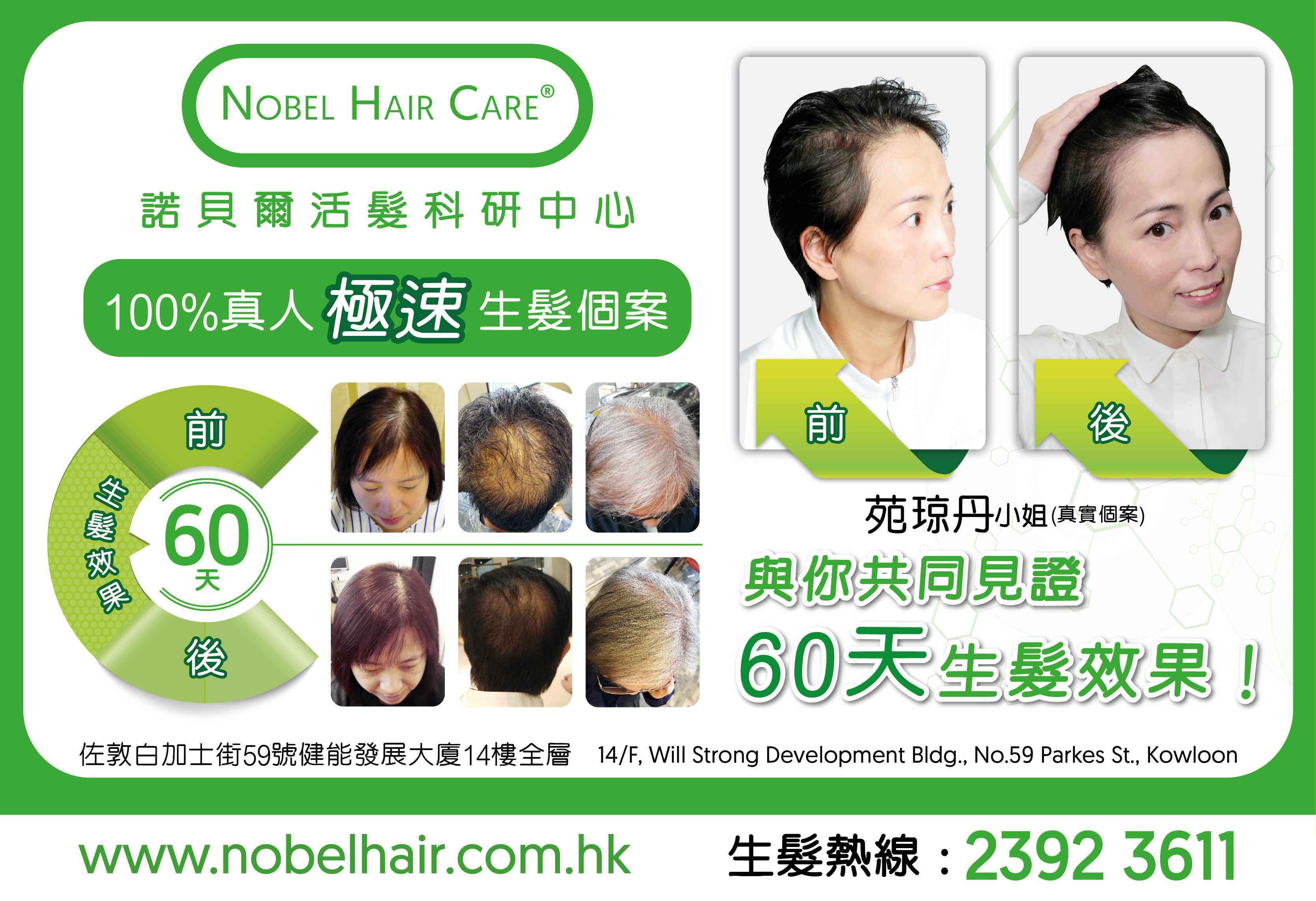 脫髮療程-生髮產品-活髮