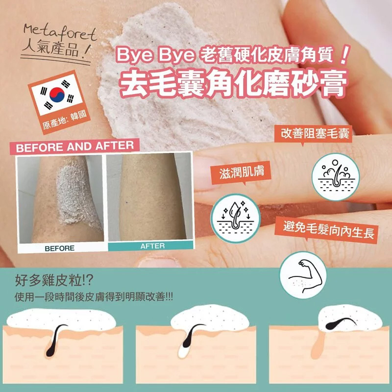 韓國製造 Metaforet 去毛囊角化磨砂膏100g 【10/19 截單，預計 :10月尾至11月中發貨】】