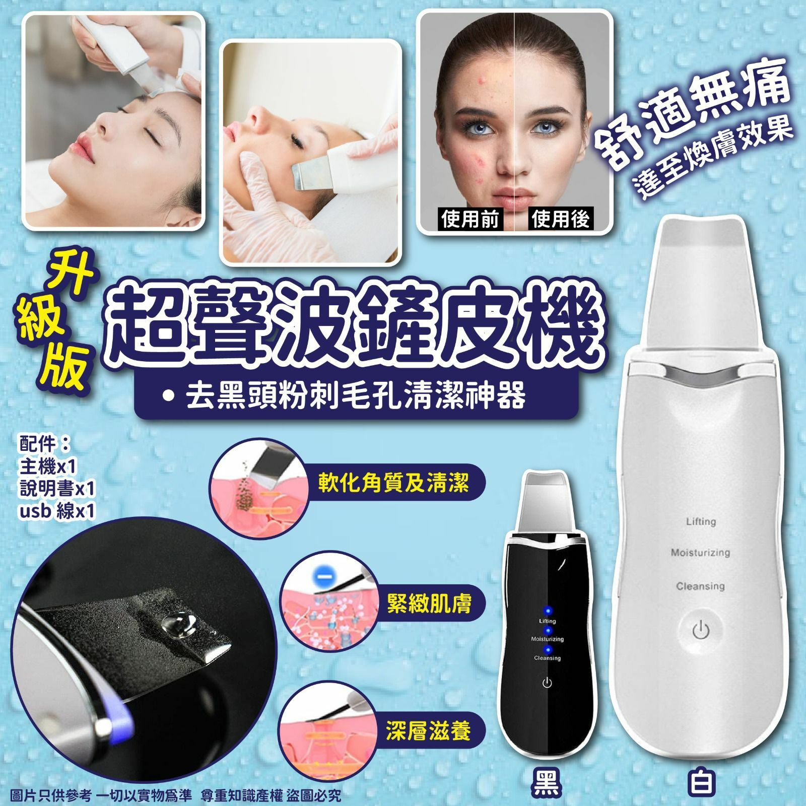 升級版超聲波鏟皮機去黑頭粉刺儀毛孔清潔神器Ultrasonic Skin Scrubber