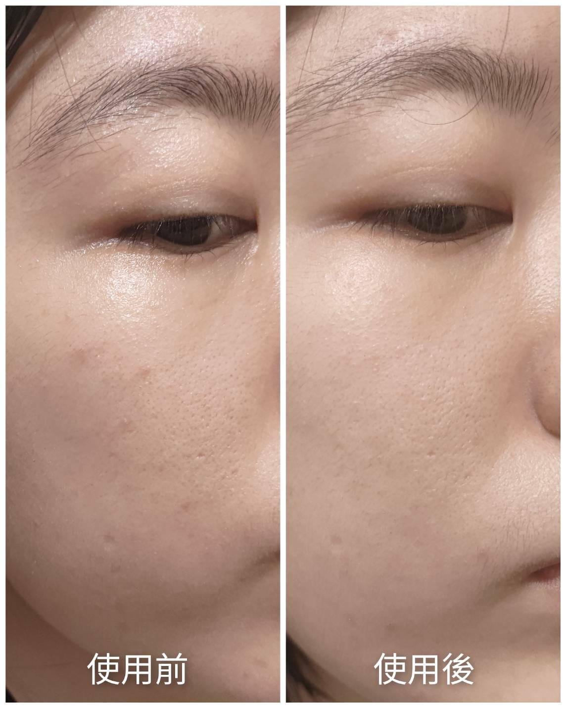 LEGERE 蘭吉兒原液精華液 爆水肌保養1+1 7天實測見證 回購率超高 媲美專櫃 高CP