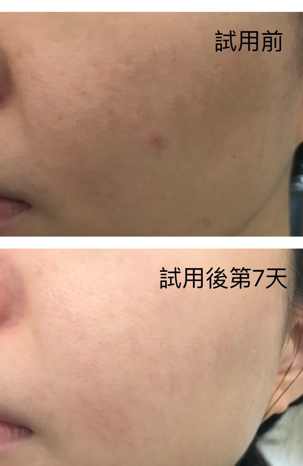 LEGERE 蘭吉兒原液精華液 爆水肌保養1+1 7天實測見證 回購率超高 媲美專櫃 高CP