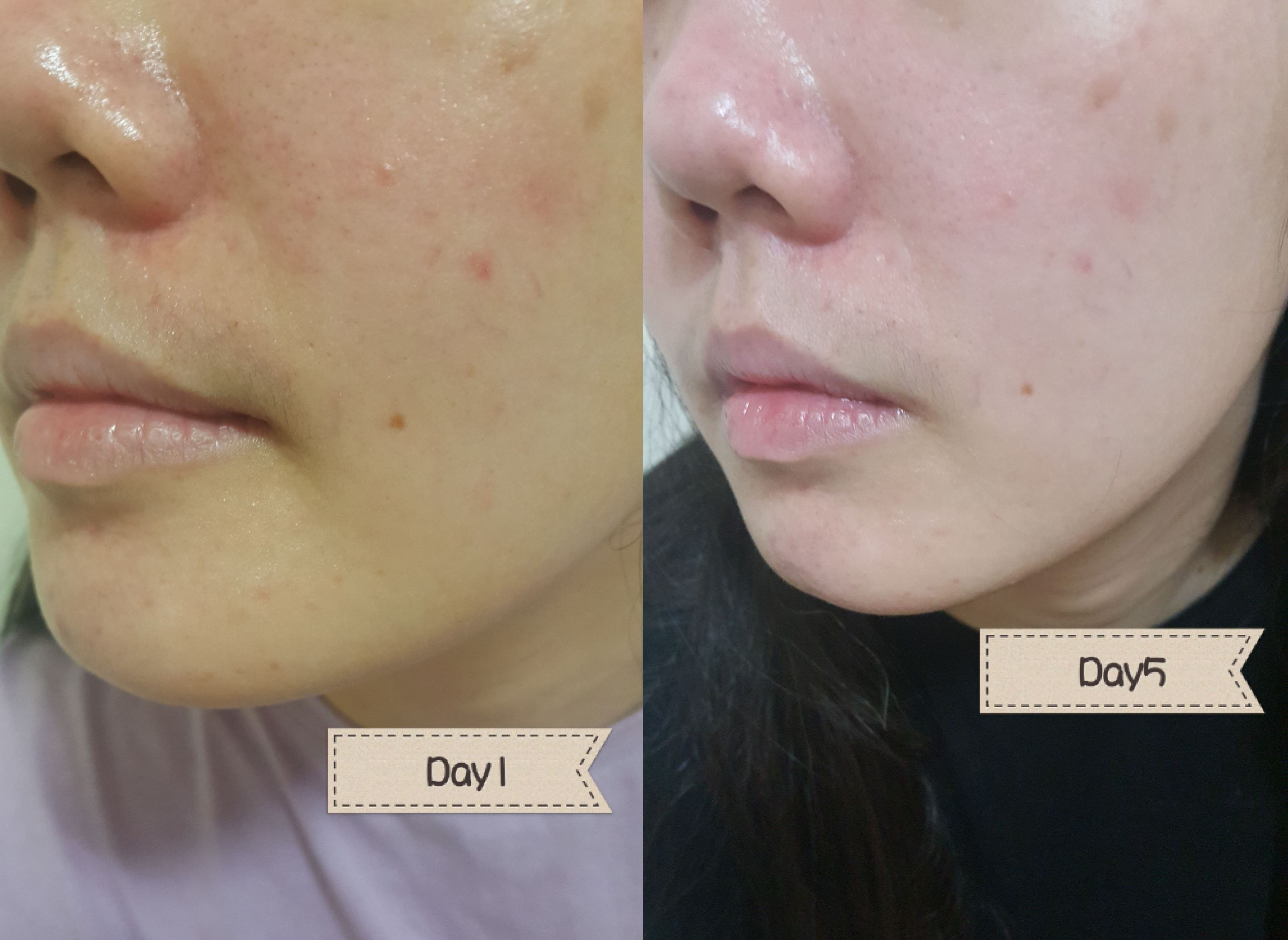 LEGERE 蘭吉兒原液精華液 爆水肌保養1+1 7天實測見證 回購率超高 媲美專櫃 高CP