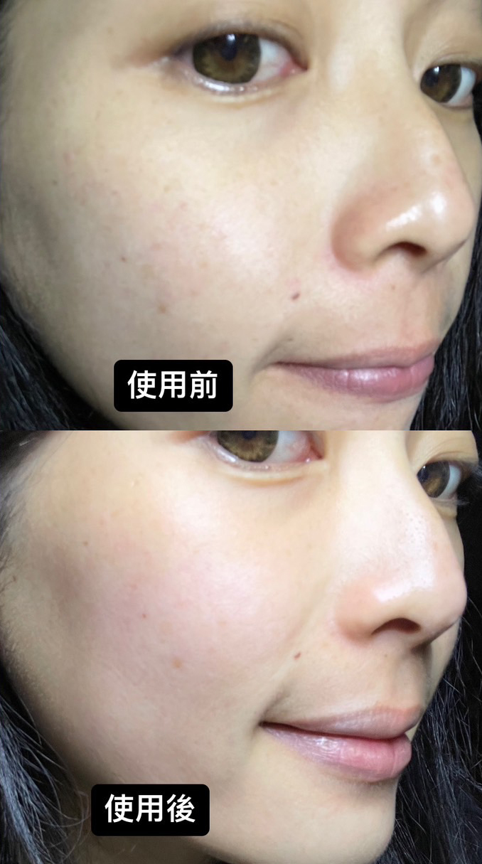 LEGERE 蘭吉兒原液精華液 爆水肌保養1+1 7天實測見證 回購率超高 媲美專櫃 高CP