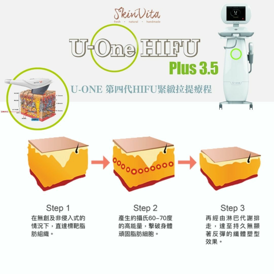 U-ONE 第四代HIFU緊緻拉提療程