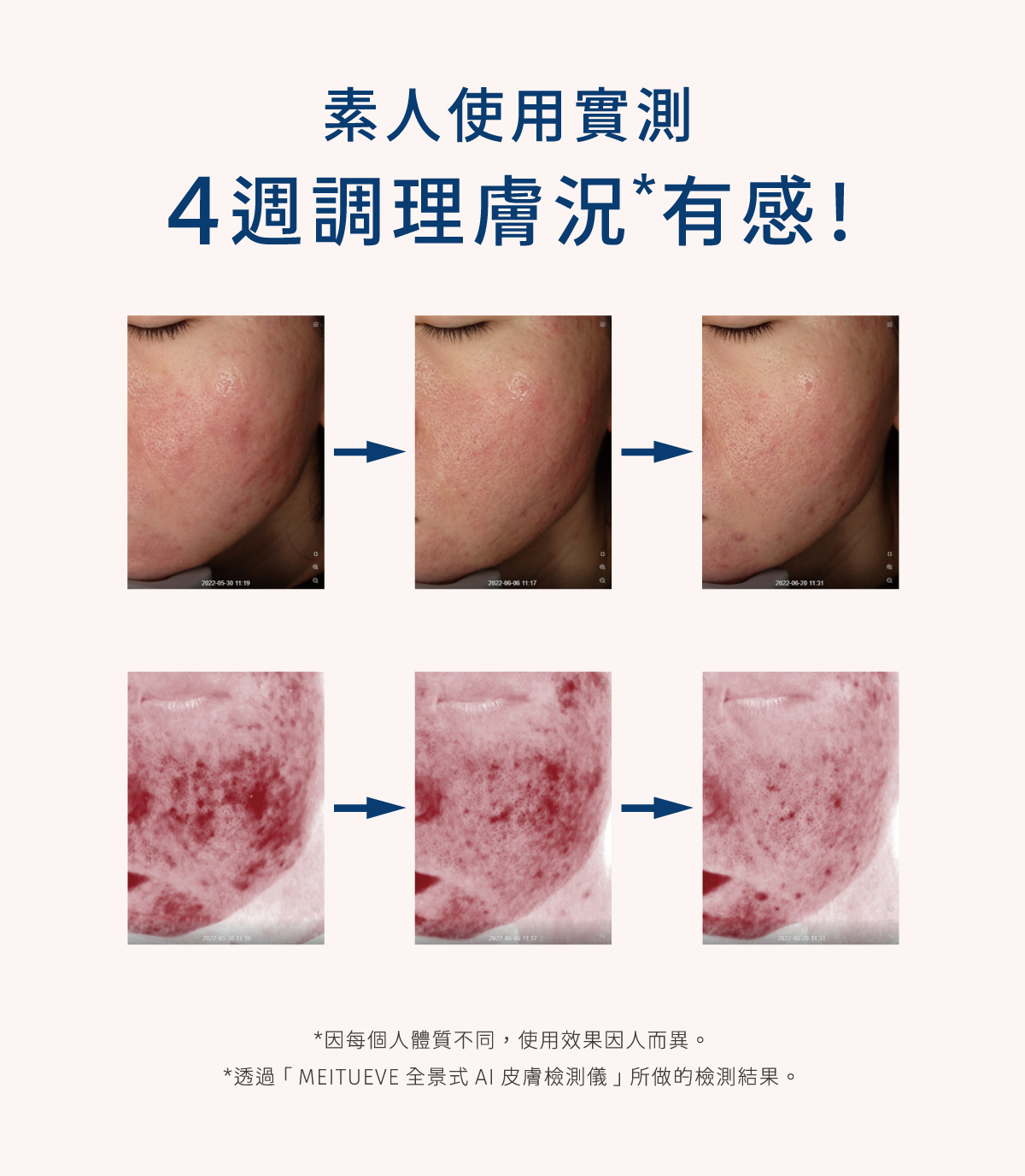 網友大推，四週調理膚況有感