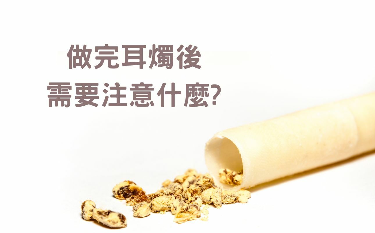 燒完耳燭的樣子，需要注意什麼？ / 逗 Doll spa 耳燭 課程