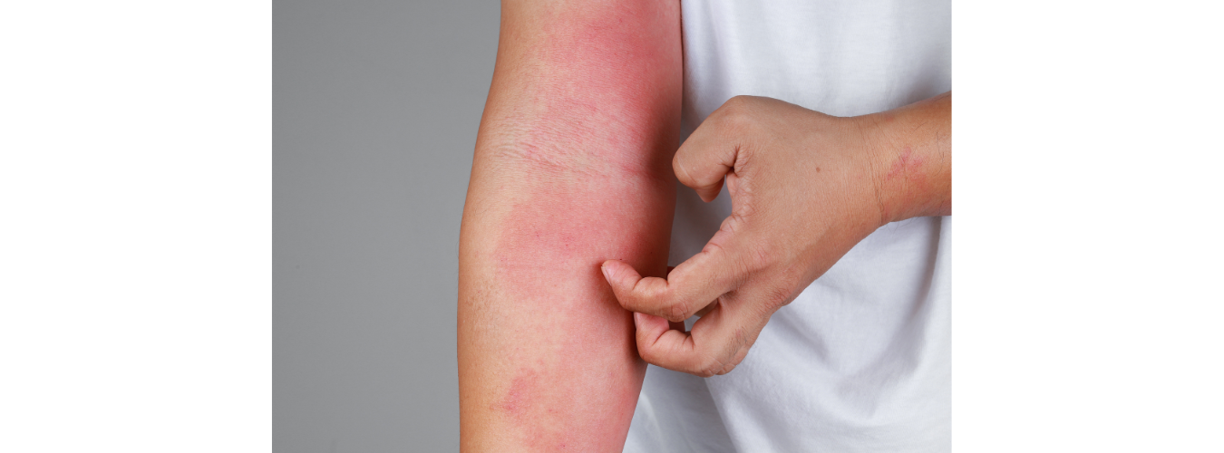 膚質不好，可能是洗澡水作怪