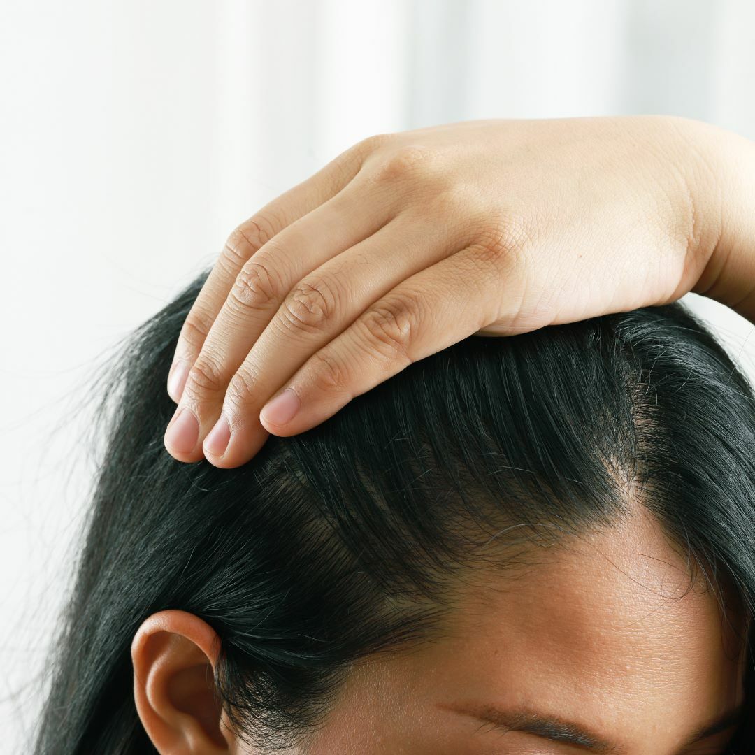 頭皮保養5課題-改善頭皮屑∣去角質∣保濕∣清潔∣強健髮根，一次搞定!