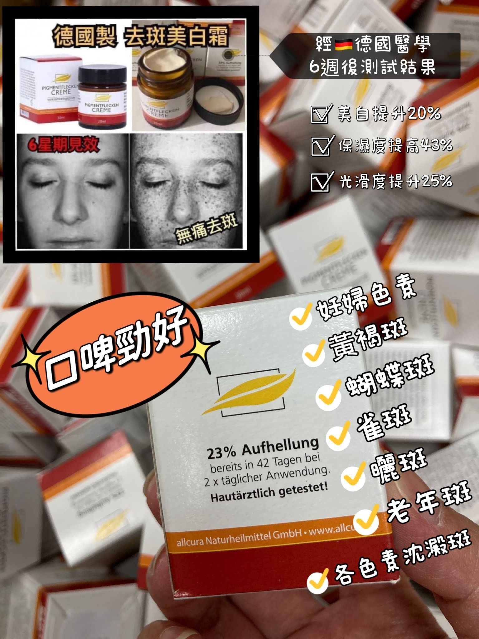 德國Pigmentflecken Creme去斑美白霜 30ml