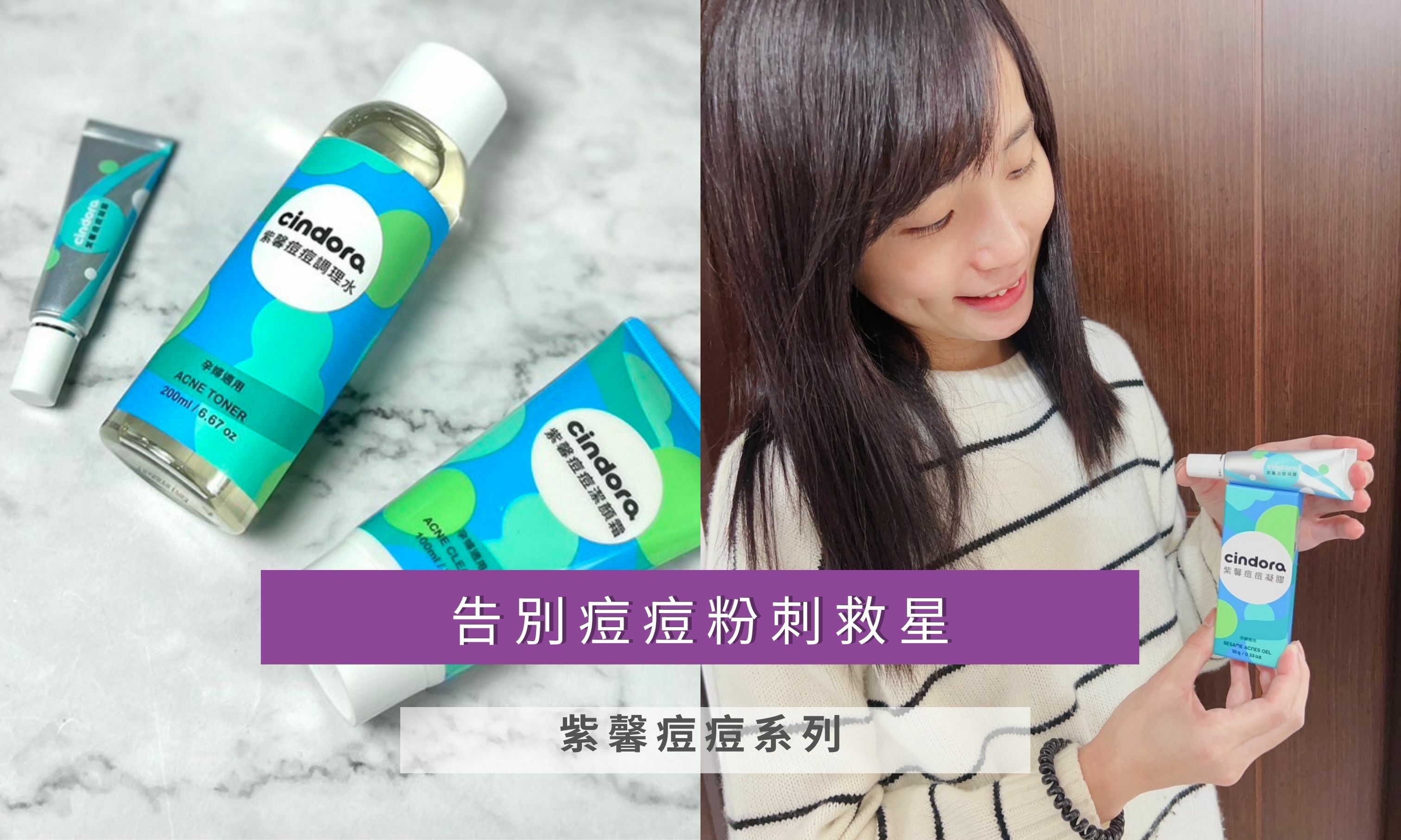 告別痘痘粉刺救星 紫馨痘痘系列