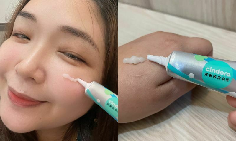 【紫馨痘痘凝膠】蘇芙蕾媽推薦，媽咪孕期抗痘痘必備好物