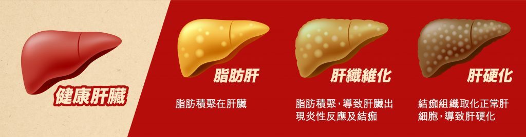 草姬健肝丸 3小時100% - 清肝排毒‧降肝脂