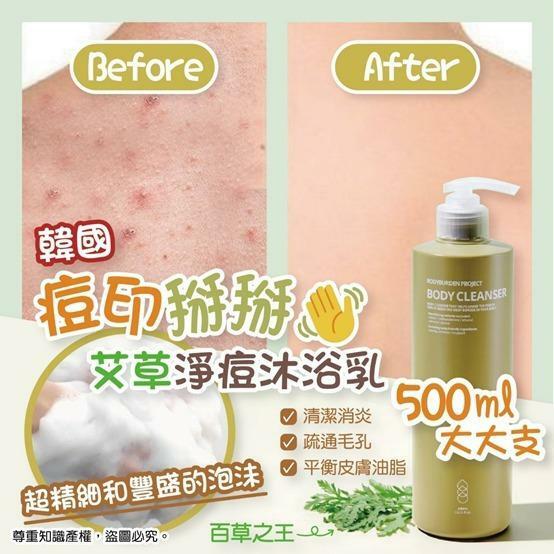 韓國痘印掰掰艾草淨痘沐浴乳