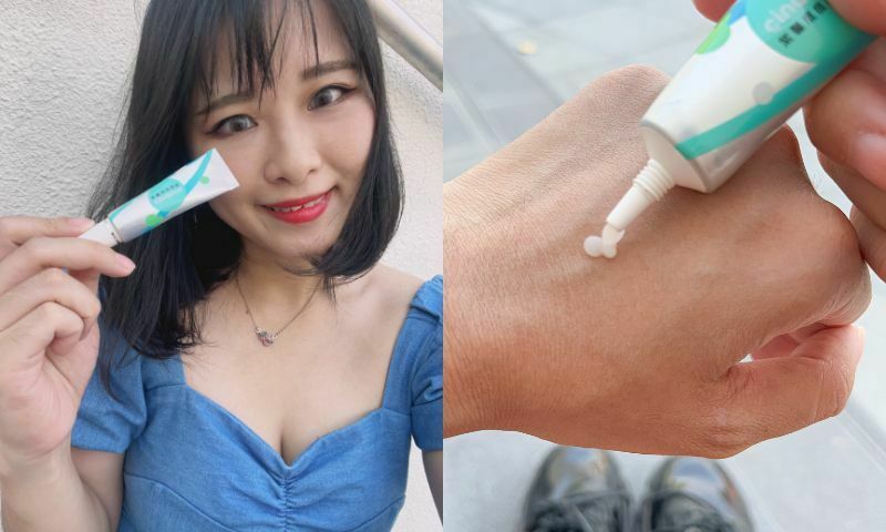 【紫馨痘痘凝膠】女漢紙和小女紙的媽推薦，媽咪孕期抗痘痘必備好物！