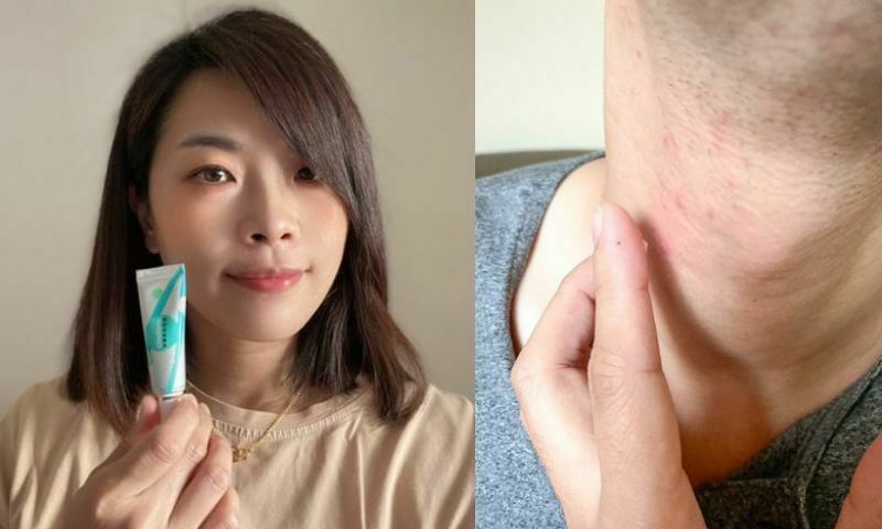 【紫馨痘痘凝膠】星星媽咪推薦，媽咪孕期抗痘痘必備好物！