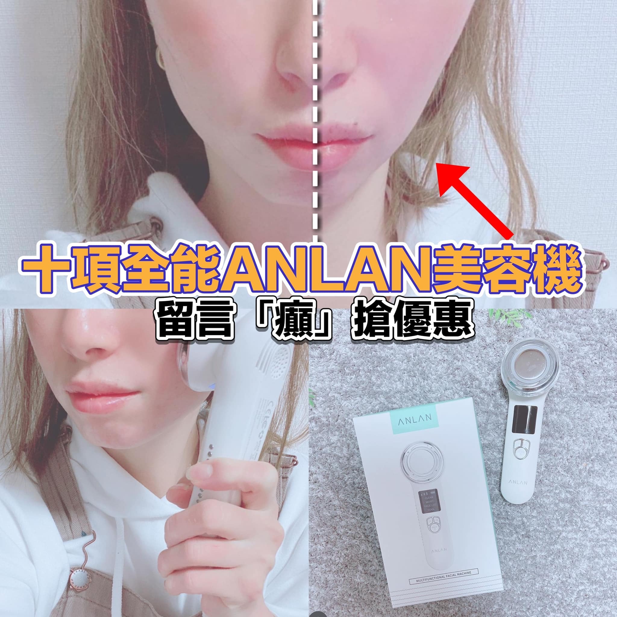 ANLAN 日本多機能溫冷美顏器｜Beauty Club 美肌物語