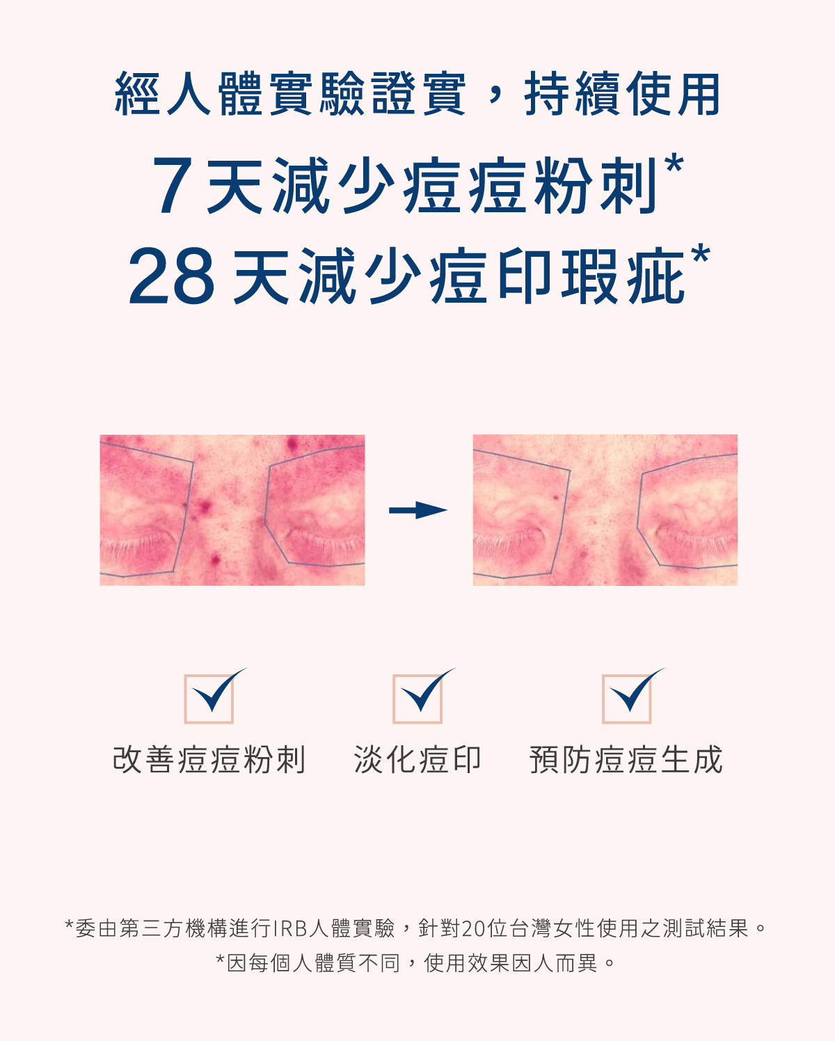 實測有效減少痘痘痘印