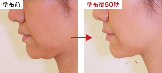 日本DR. SOIE SAIBOW Serum 60秒埋線精華10ml
